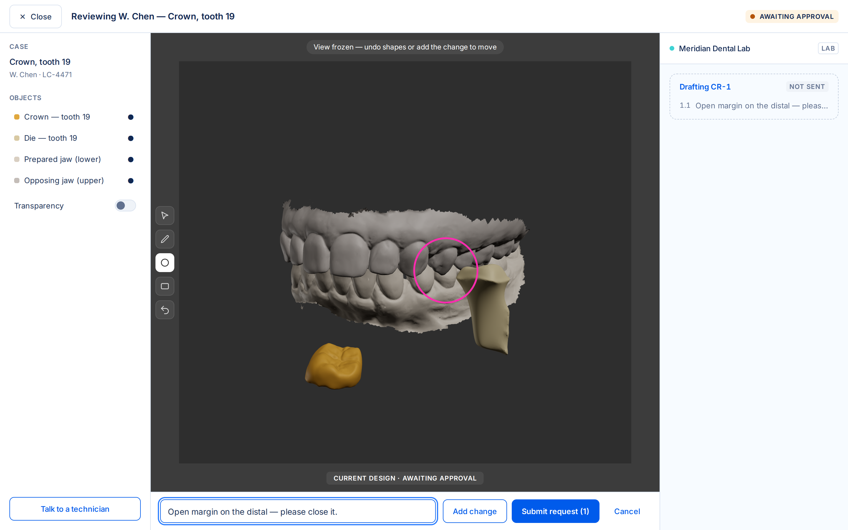 The Lecron design preview: a dentist reviewing a 3D crown design with an annotation marked on the margin.